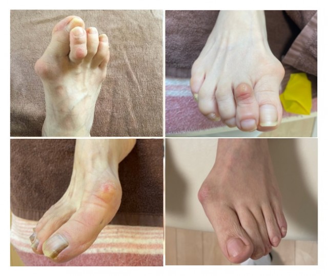 足痛・膝痛・慢性腰痛・腰痛
