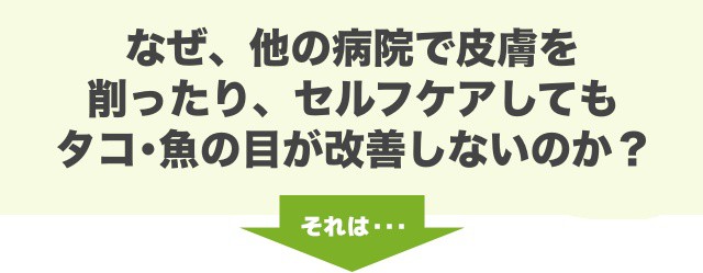 なぜ、他の病院で皮膚を削ったり、セルフケアしてもタコ・魚の目が改善しないのか？