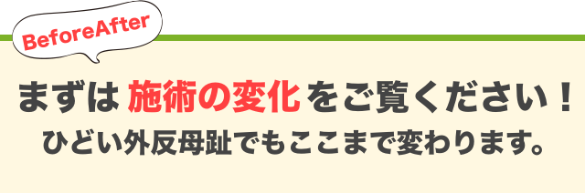 施術の変化