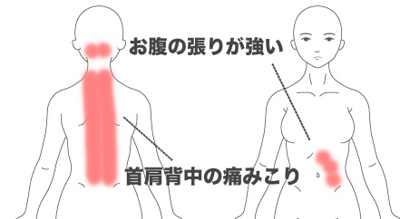 30代 女性 6ヶ月前から自律神経失調症で休職していた不調が仕事復帰するまでに たに整体院 桜井 橿原 土日祝営業